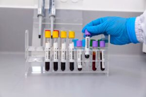Laboratorios clínicos cerca de mi ubicación – servicio 24 horas