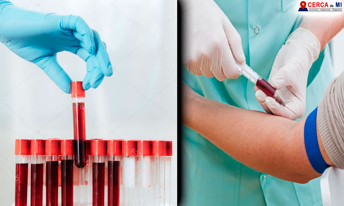Biometría hemática precio: Qué es, enfermedades que pueden diagnosticarse, laboratorios dónde hacerla